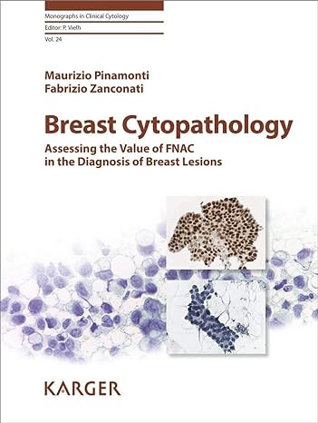 Breast Cytopathology : Assessing the Value of FNAC in the Diagnosis of Breast Lesions