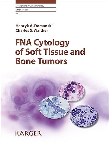 FNA Cytology of Soft Tissue and Bone Tumors