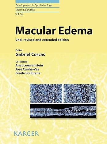 Macular Edema