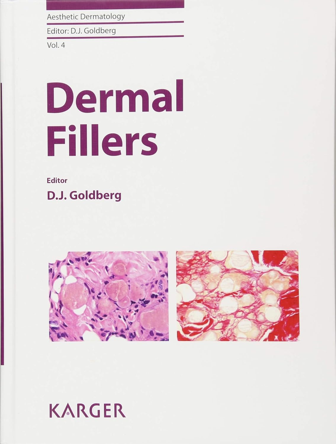 Dermal Fillers