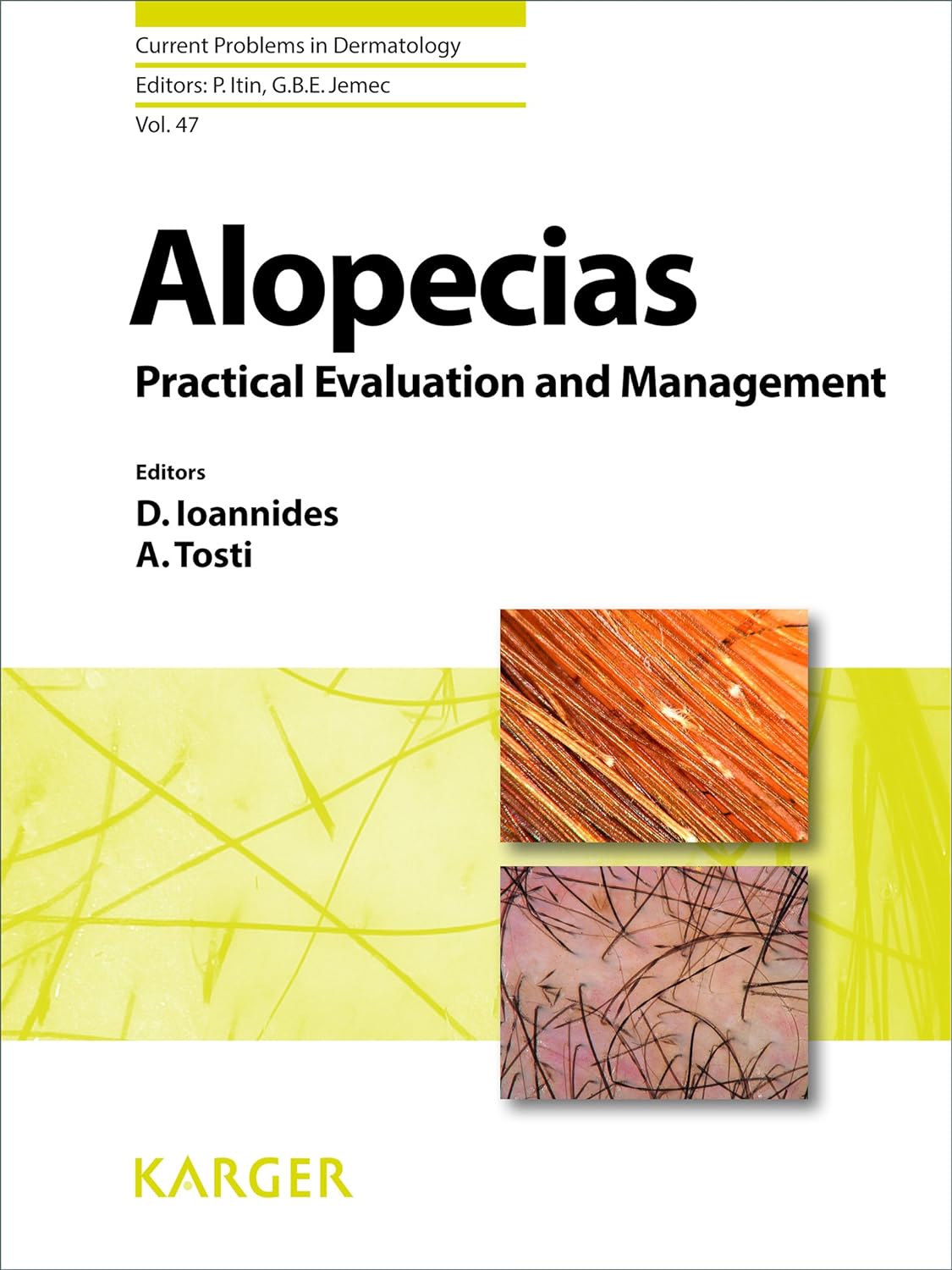 Alopecias - Practical Evaluation and Management