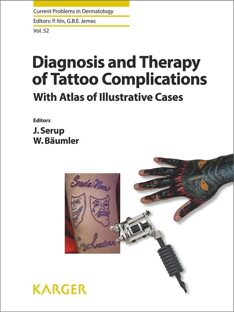 Diagnosis and Therapy of Tattoo Complications : With Atlas of Illustrative Cases