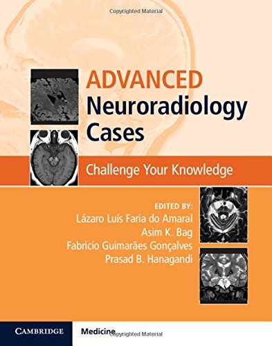 Advanced Neuroradiology Cases: Challenge Your Knowledge