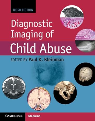 Diagnostic Imaging of Child Abuse