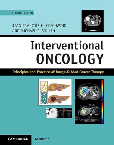 Interventional Oncology: Principles and Practice of Image-Guided Cancer Therapy