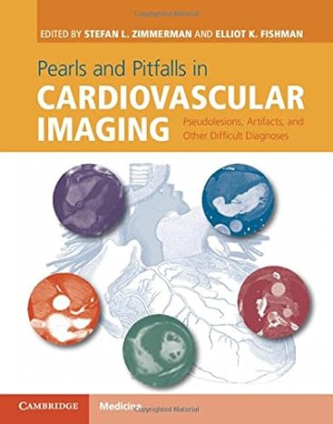 Pearls and Pitfalls in Cardiovascular Imaging: Pseudolesions, Artifacts, and Other Difficult Diagnoses