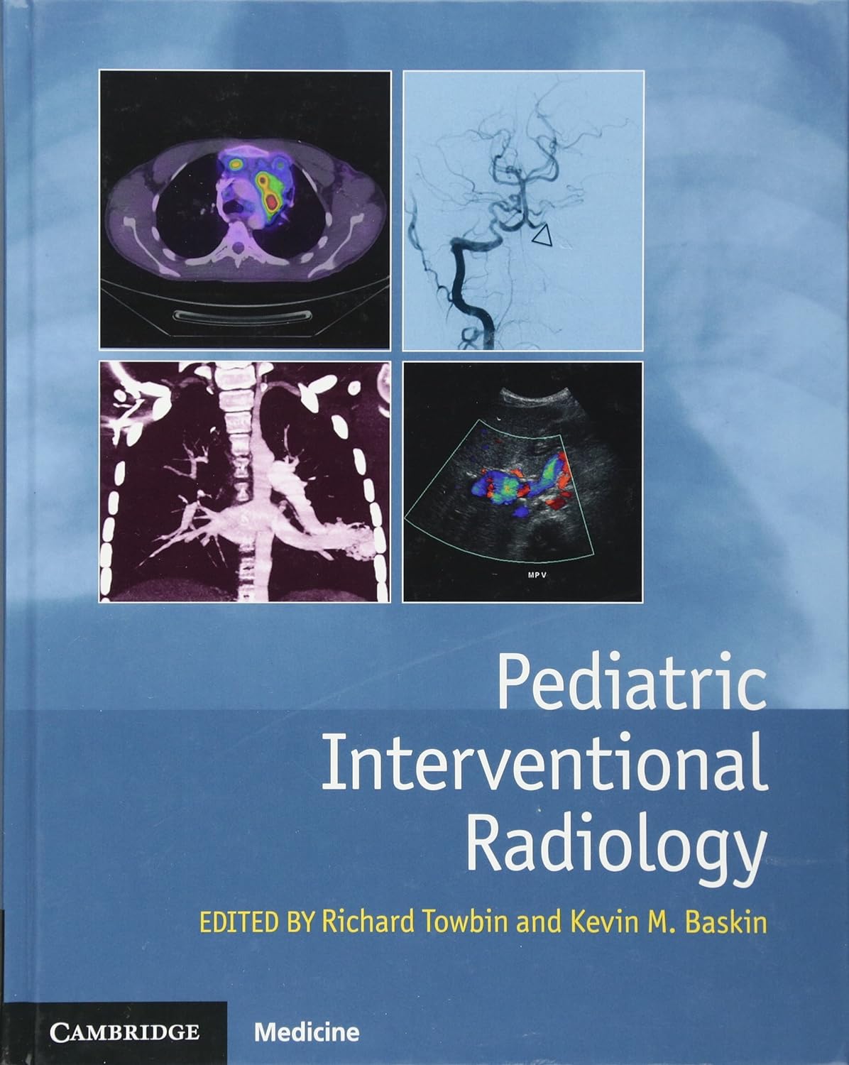 Pediatric Interventional Radiology