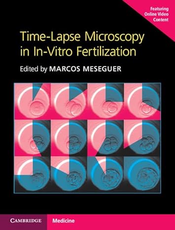 Time-Lapse Microscopy in In-Vitro Fertilization Hardback with Online Resource