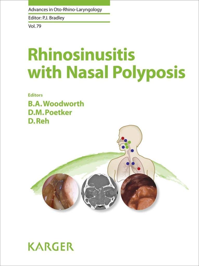 Rhinosinusitis with Nasal Polyposis : With a foreword by D.W. Kennedy (Philadelphia, Pa.)