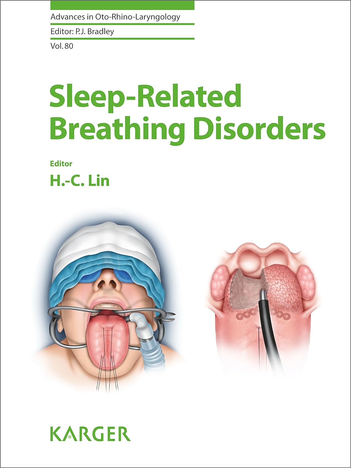 Sleep-Related Breathing Disorders