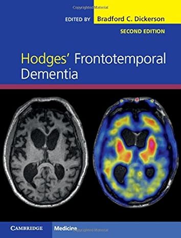 Hodges Frontotemporal Dementia